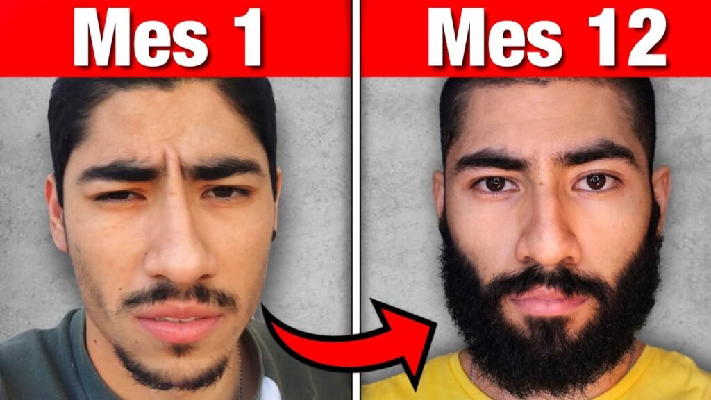 Fotos del antes y después de mi barba en crecimiento con minoxidil