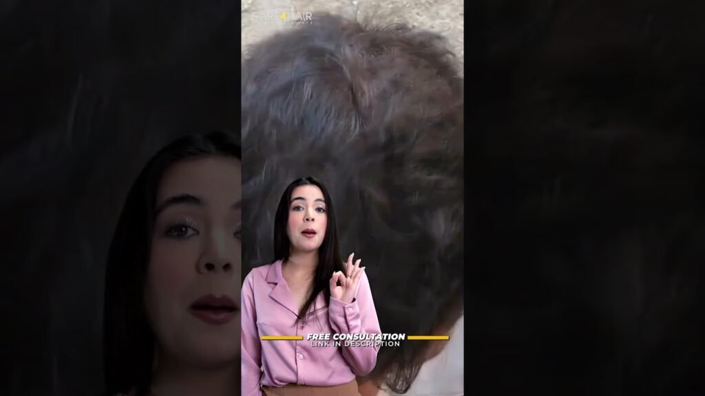 Qué hacer si el minoxidil y sensibilidad extrema genera crecimiento no deseado de vello