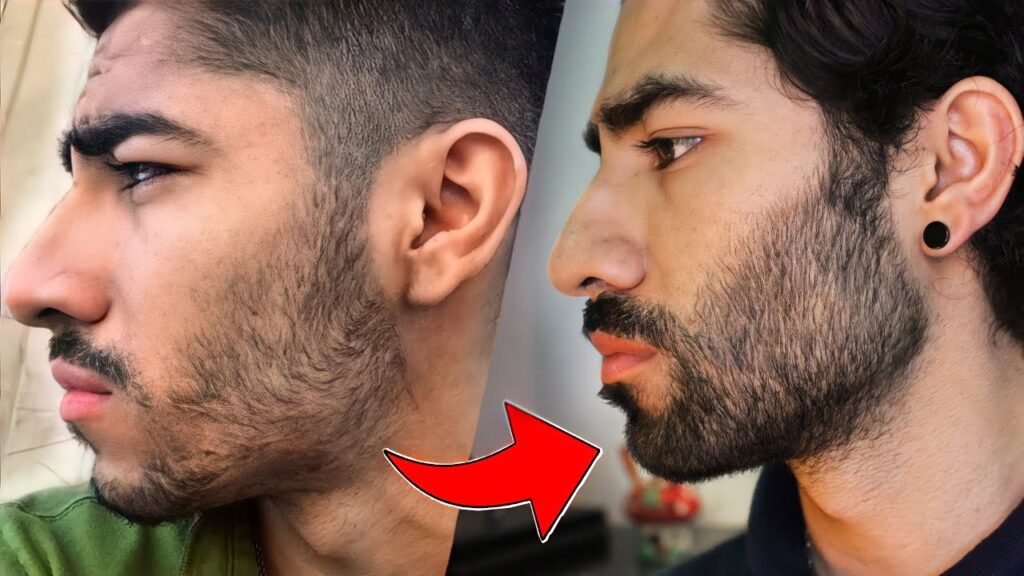 Cómo combinar minoxidil con aceites naturales para mejorar la barba juvenil