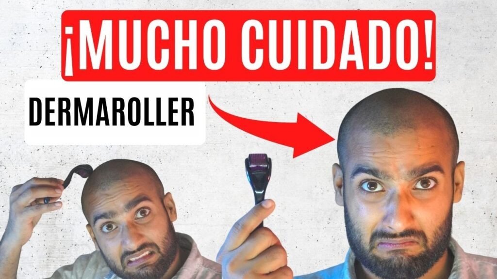 Cómo usar dermaroller junto con minoxidil para tratamiento facial