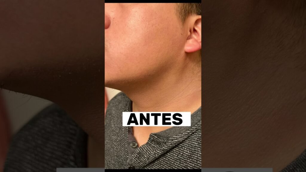 Testimonio: qué sentí al ver crecer mi proceso con minoxidil por primera vez