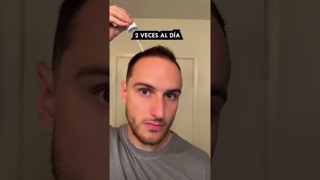 La historia de mi transformación con historia inspiradora y minoxidil