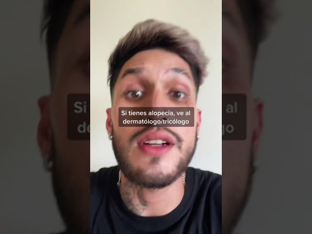 Cómo combinar minoxidil con suplementos para el entradas pronunciadas