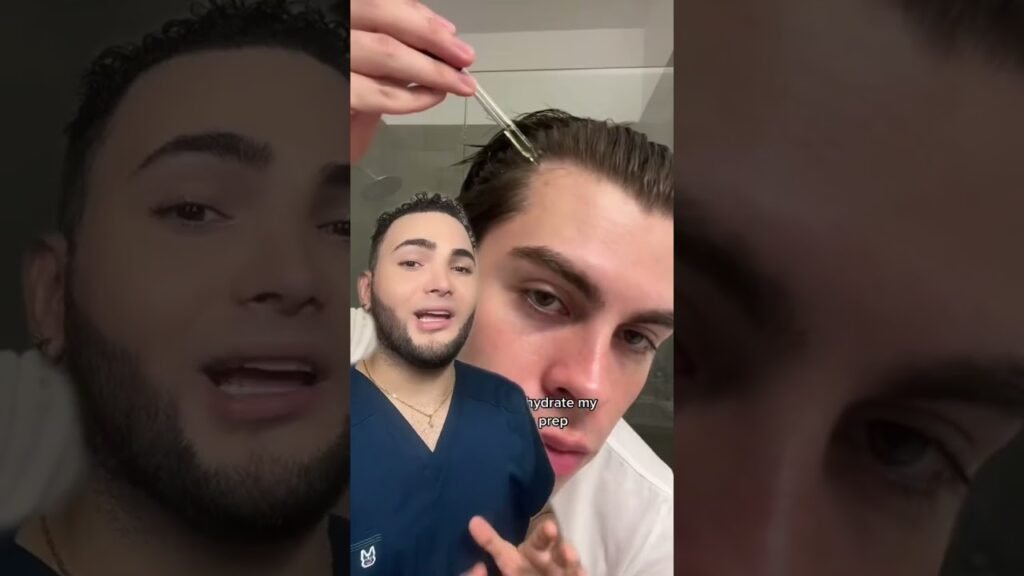 Cómo combinar minoxidil en la barba rala con dermaroller sin dañar la piel