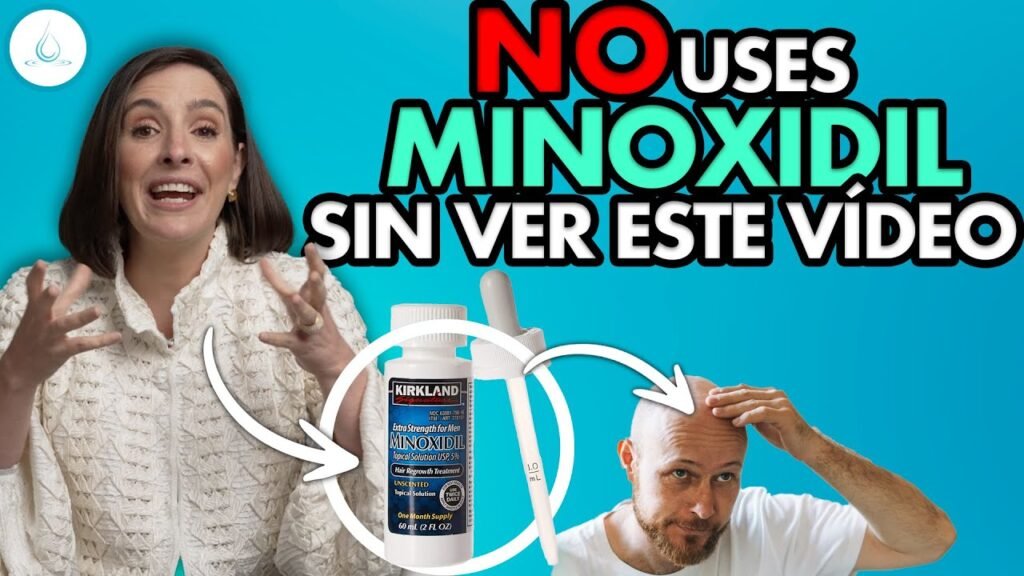 Qué resultados esperar del minoxidil en mujeres con pérdida de entradas pronunciadas