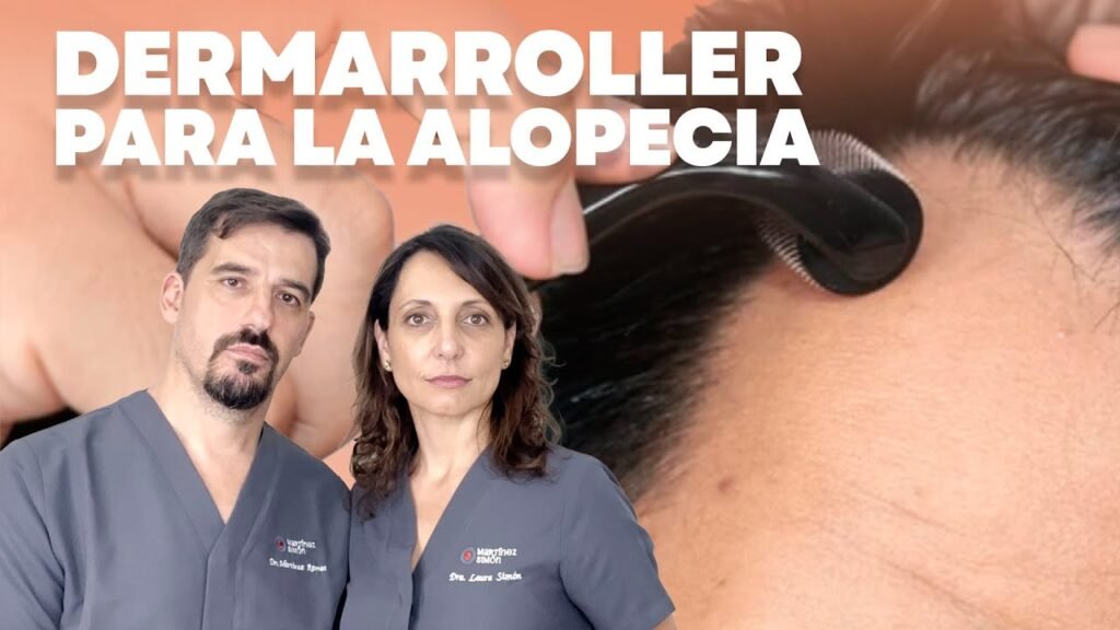 Cómo combinar minoxidil en la cuero cabelludo con dermaroller sin dañar la piel