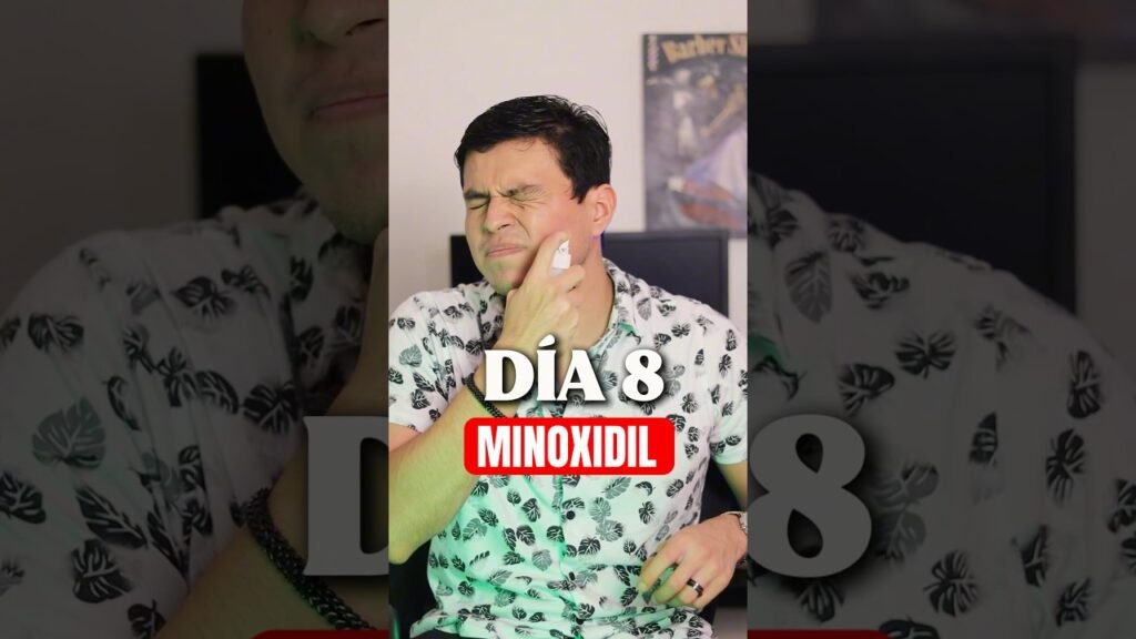 Mi experiencia personal usando minoxidil en crema para logro personal