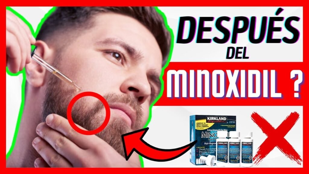 Puedo usar maquillaje después de aplicar minoxidil en la barba rala