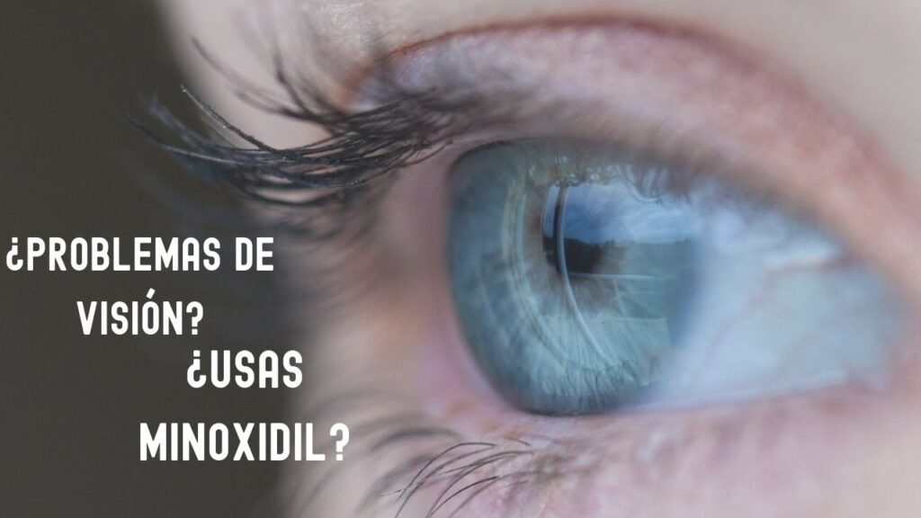 Qué hacer si el minoxidil en la zona afectada entra en contacto con los ojos