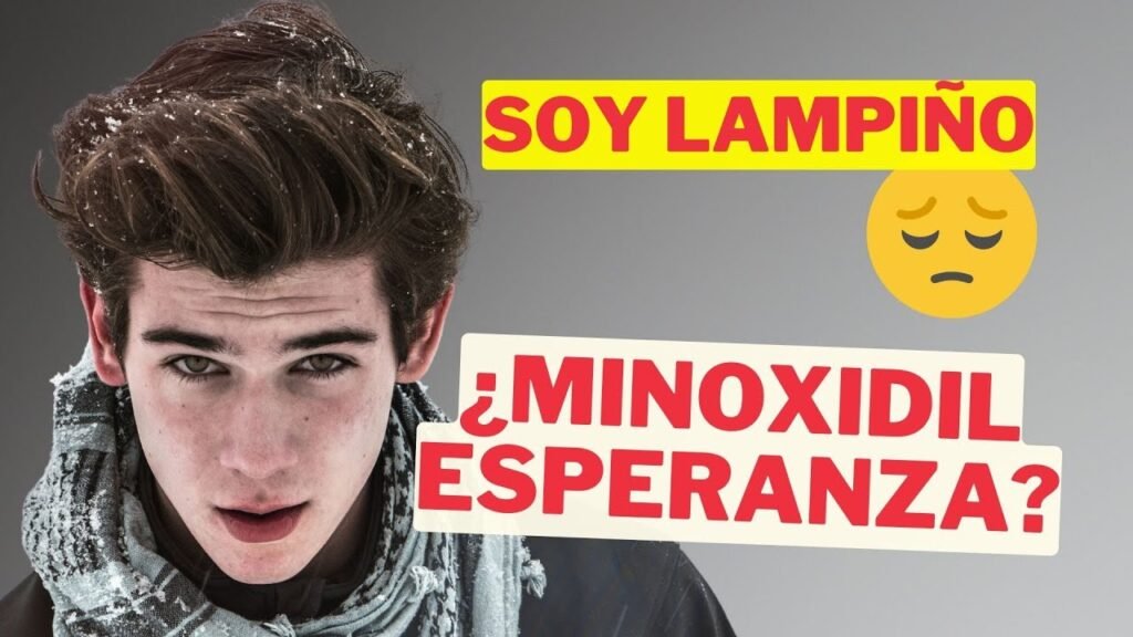 You Minox en Perú: qué dicen los expertos